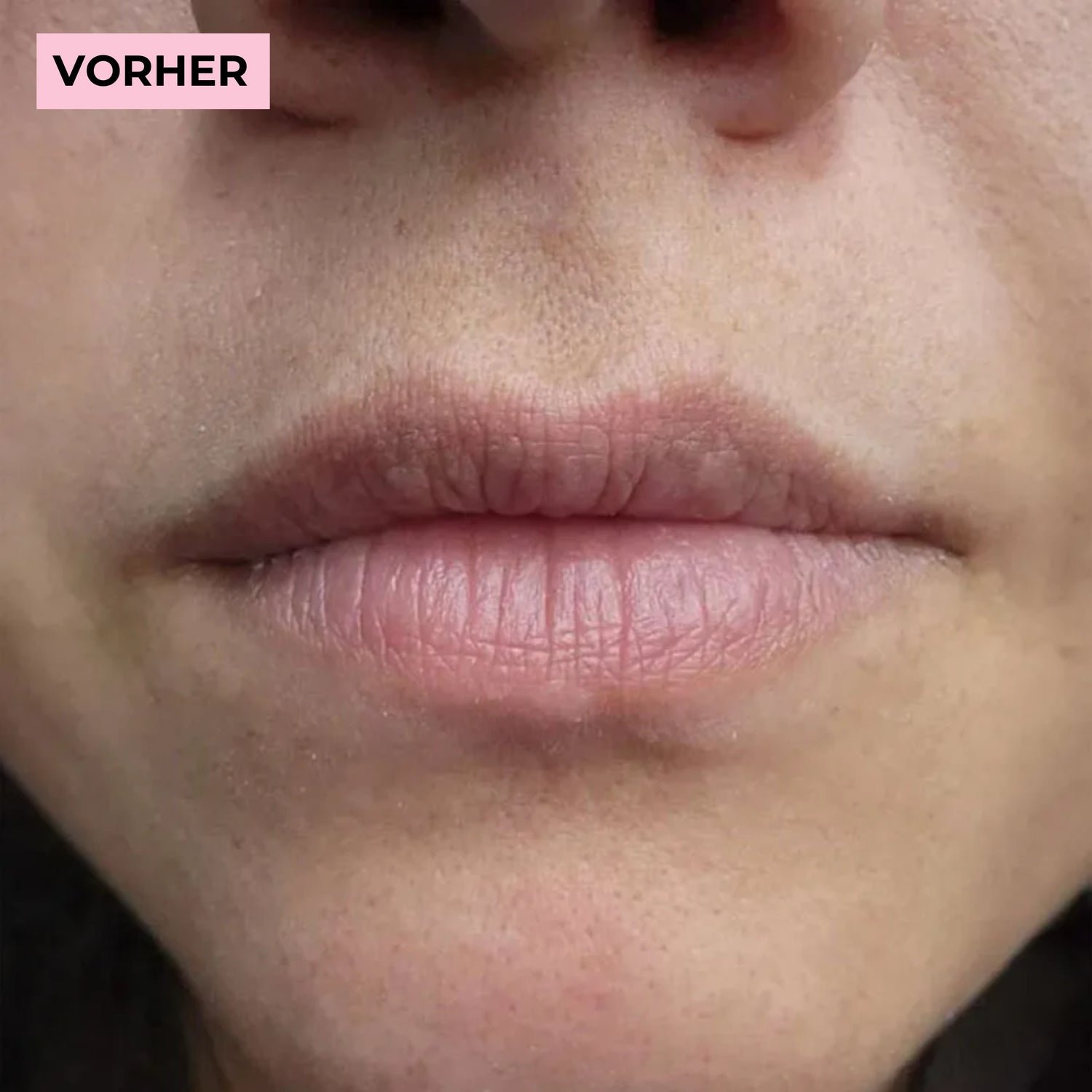 image comparison before