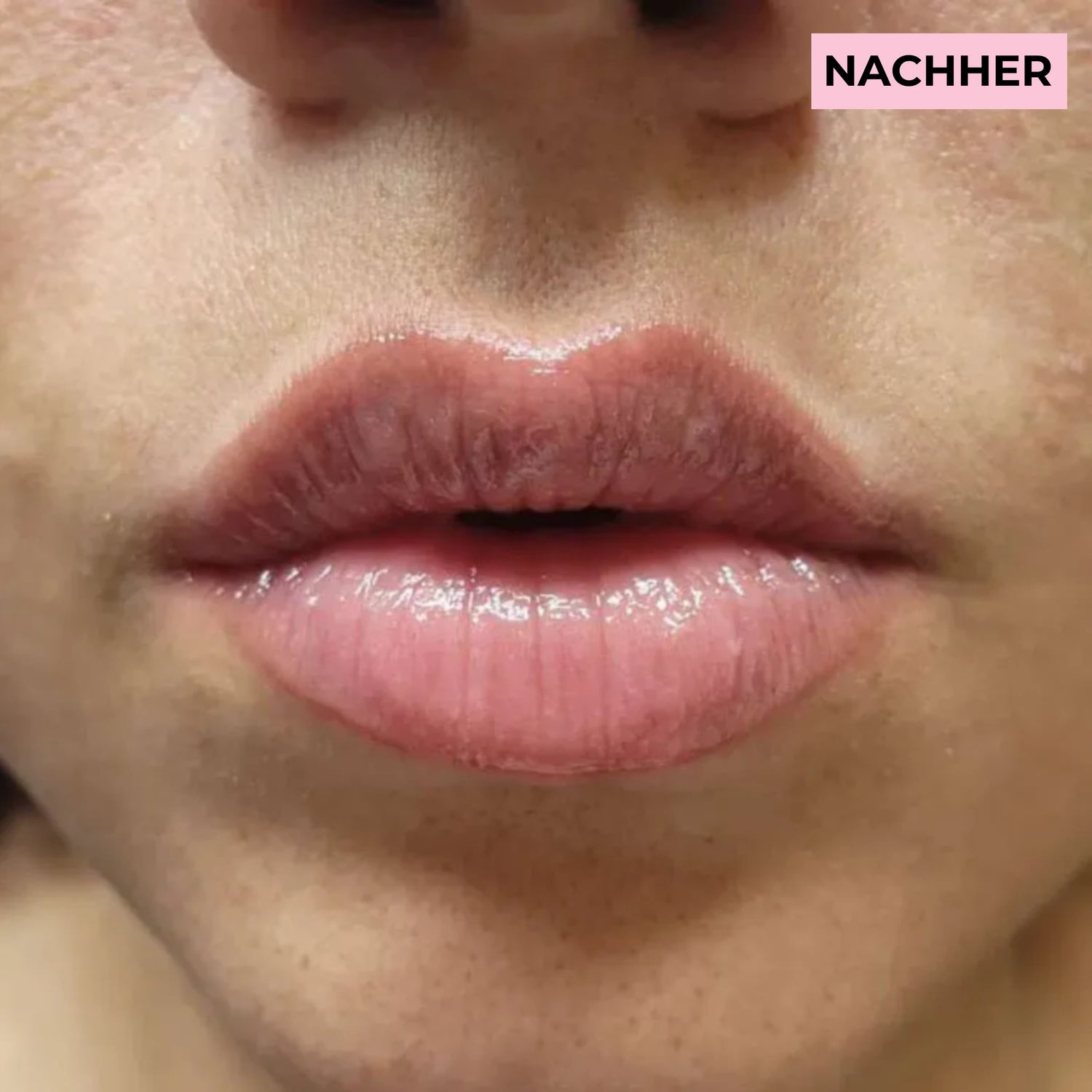 image comparison after